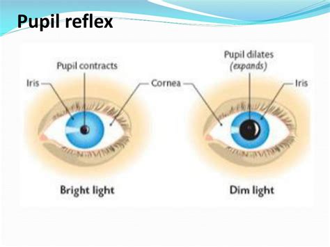 minimocaof|Altered pupil light and darkness reflex and eye.